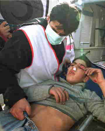 26日、ラマラ（Ramallah）のデモでイスラエル兵のゴム弾で顔を撃たれた少年､ほか50人以上の参加者が負傷した。